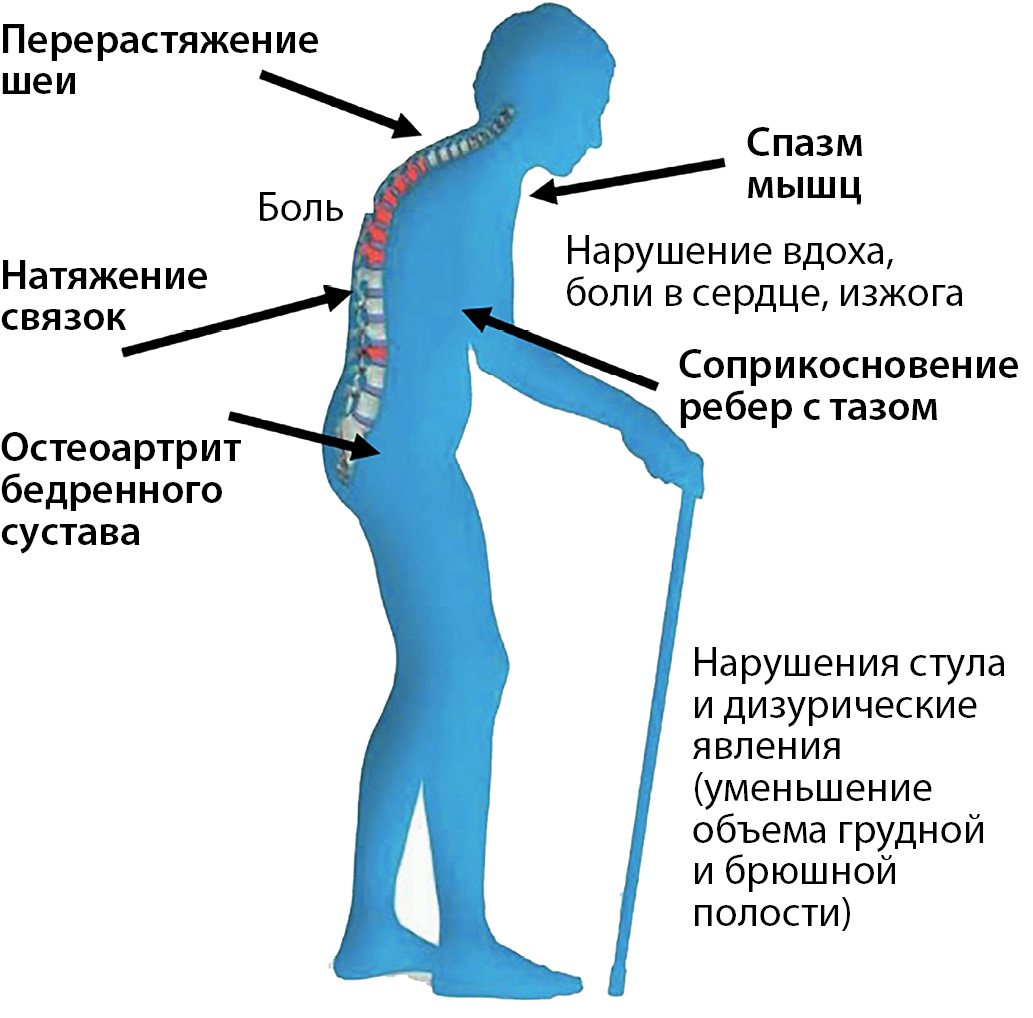 Ноющая боль в костях