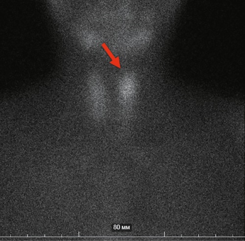 Изображение на обложке